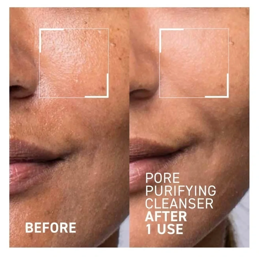Dr Brandt Pores No More Pore Purifying Cleanser 3.5 oz